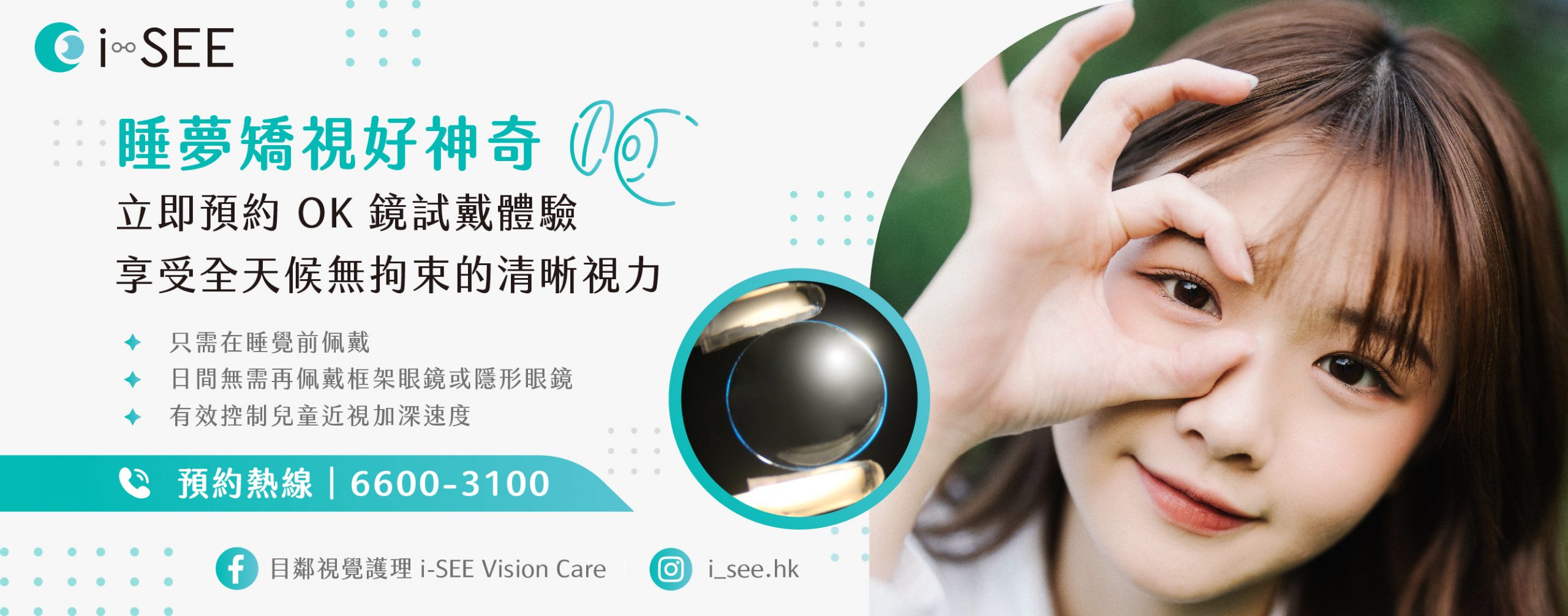 香港角膜矯型術（OK鏡）